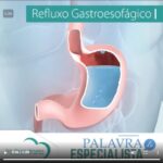 Refluxo gastroesofágico